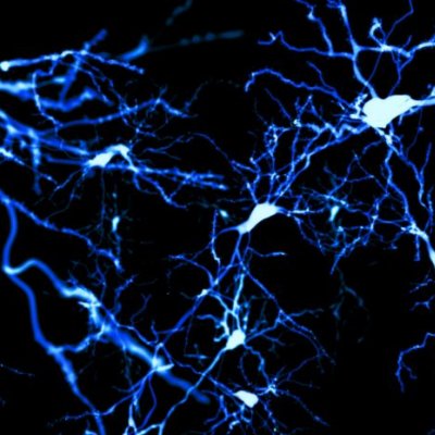 A graphic of light blue tissue connecting at points against a dark blue background.